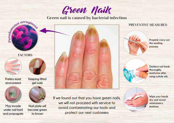 green nails infographic by kiyosa