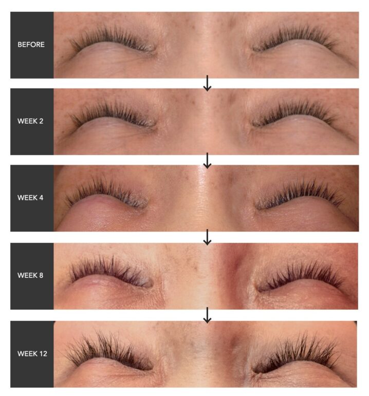 Lashaddict makes your eyelash thick and long in 12 weeks!